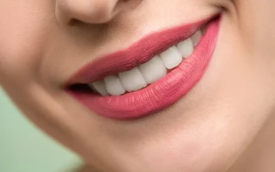 Blanchiment des dents Nyon : Tout ce que vous devez savoir